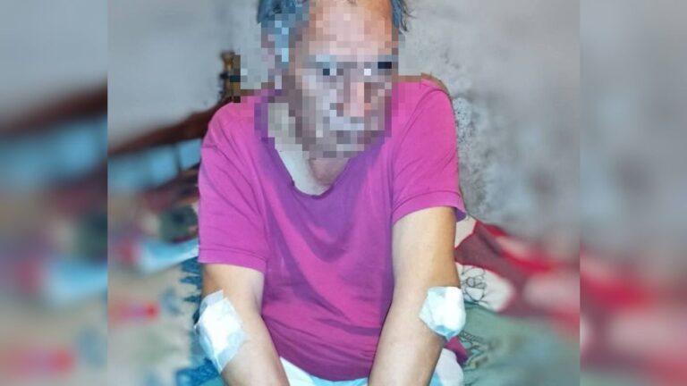 Un hombre cayó de una colectivo en movimiento y sufrió múltiples lesiones