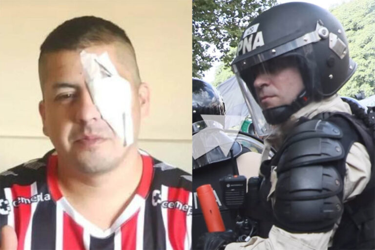 Identificaron al prefecto que le disparó en el ojo a Jonathan Navarro