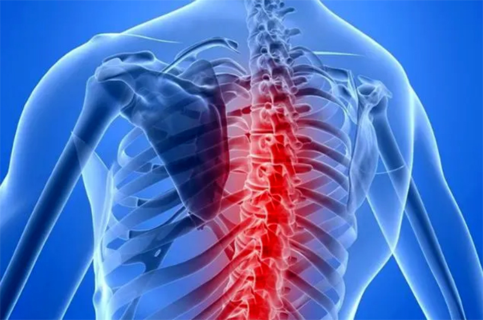 Por unanimidad, aprobaron el proyecto para detectar tempranamente la atrofia muscular espinal