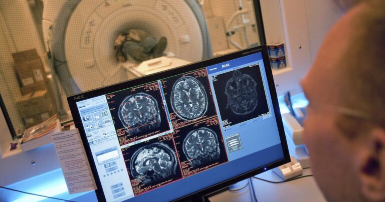 Encuentran una secuela cerebral más persistente de lo que se creía en ex rugbiers y boxeadores retirados